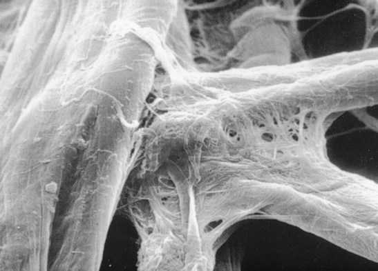 Magnification 1500x Numerous fibers come together at one place within a paper sheet forming a massive bonded area. Used with permission Arnold Grummer's ® 2014 www.arnoldgrummer.com